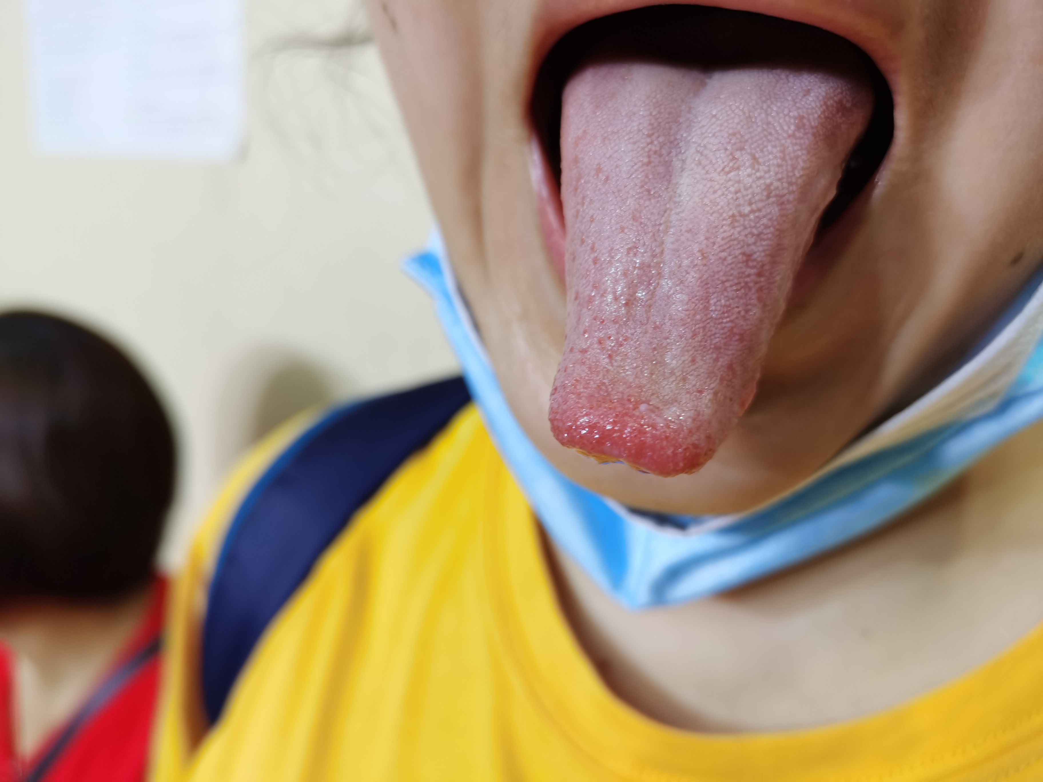 女，32 反复流产2年.jpg