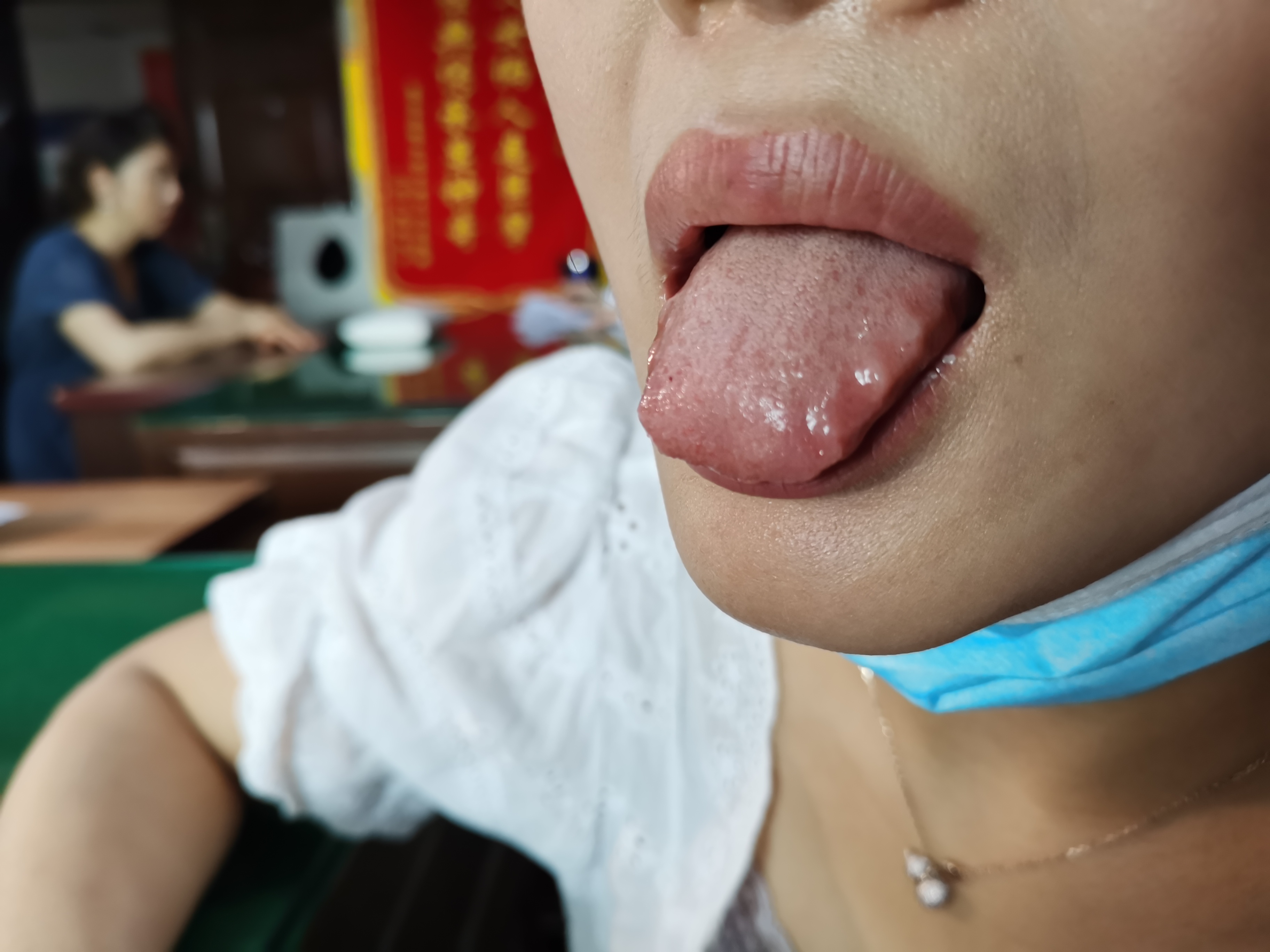 女，37岁，乏力疲劳3年余 舌面.jpg